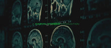 Charger l&#39;image dans la galerie, Radiographie de Bruce Banner - L&#39;incroyable Hulk avec Edward Norton
